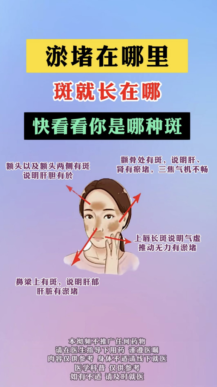 淤堵在哪里,斑就长在哪,快看看你是哪种斑: 一