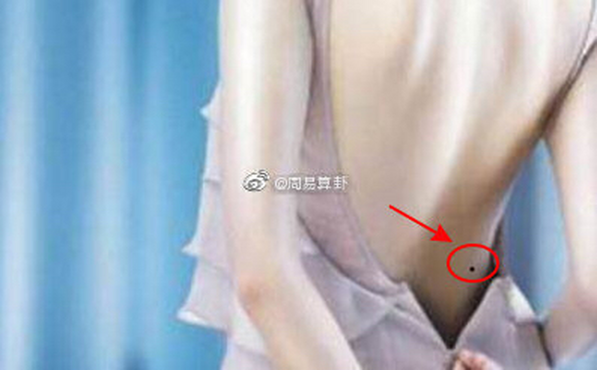 "腰上长痣,腰缠万贯".你有没有呢?