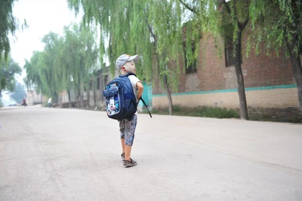 回顾山西"面具娃娃":遭大火烧伤心理扭曲,被小朋友排挤,后怎样