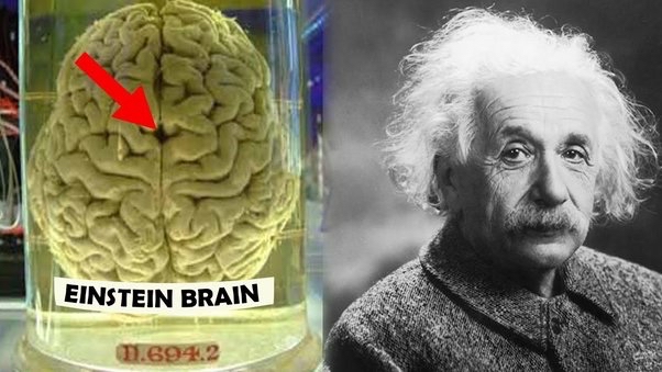 研究爱因斯坦的大脑发现了些什么?你绝对想象不到