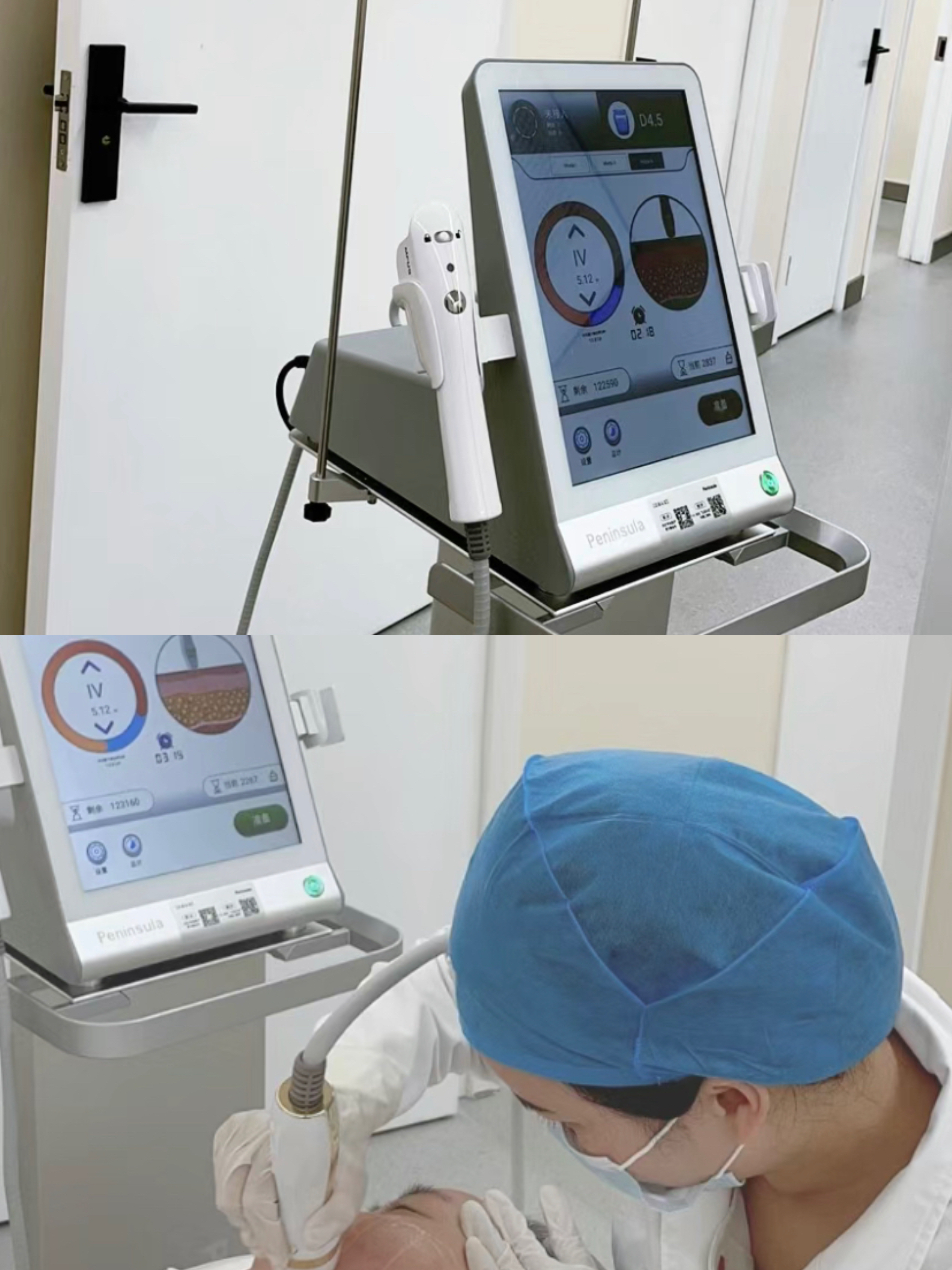 超声刀美容的功效和副作用 超声刀是物理性质的医疗美容方式,会破坏