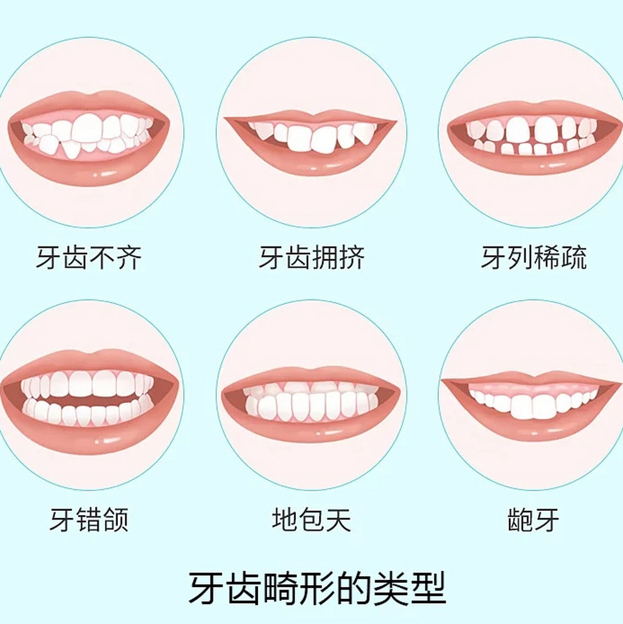 各种畸形牙的分类图片图片