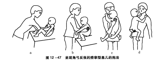 脑瘫儿抱起来图片图片