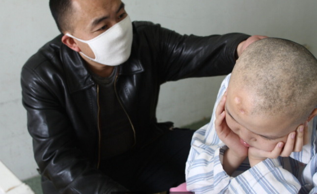 癌症患者自述:死亡都是奢侈,我真的太疼了!癌痛到底有多痛?