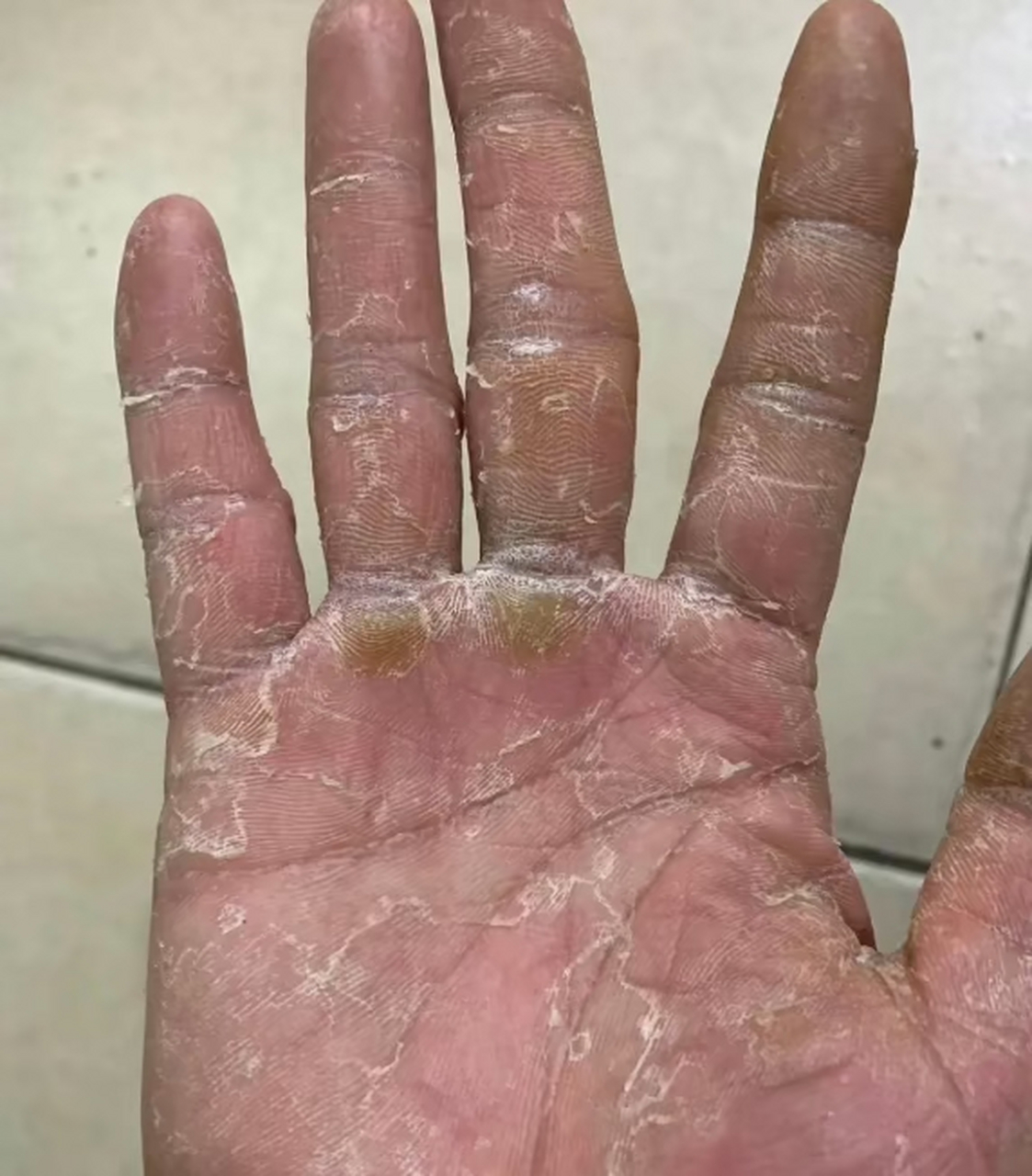 一双操劳的手,不知道还能不能找得到女朋友