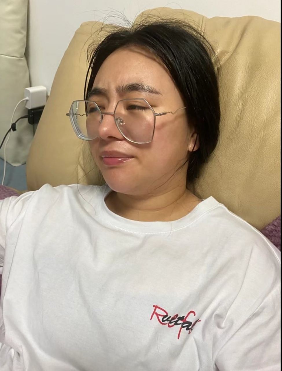 甲减好了! 面容对比图来了