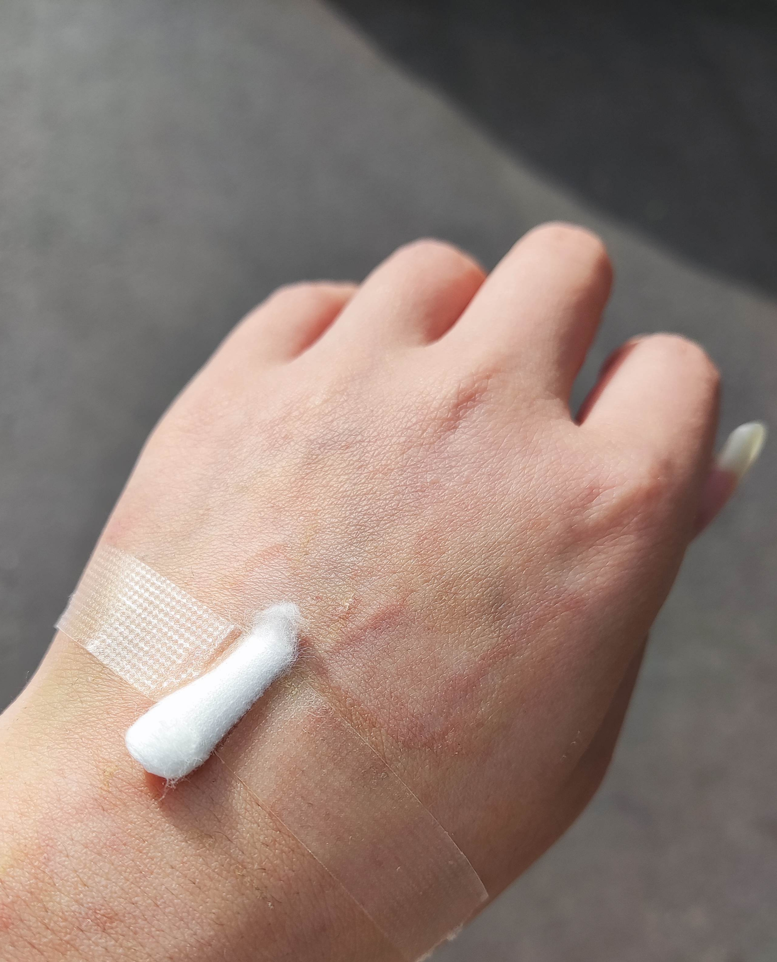 今天我还在发烧打吊瓶的时候 我同事给我发钉钉说老板一大早开会