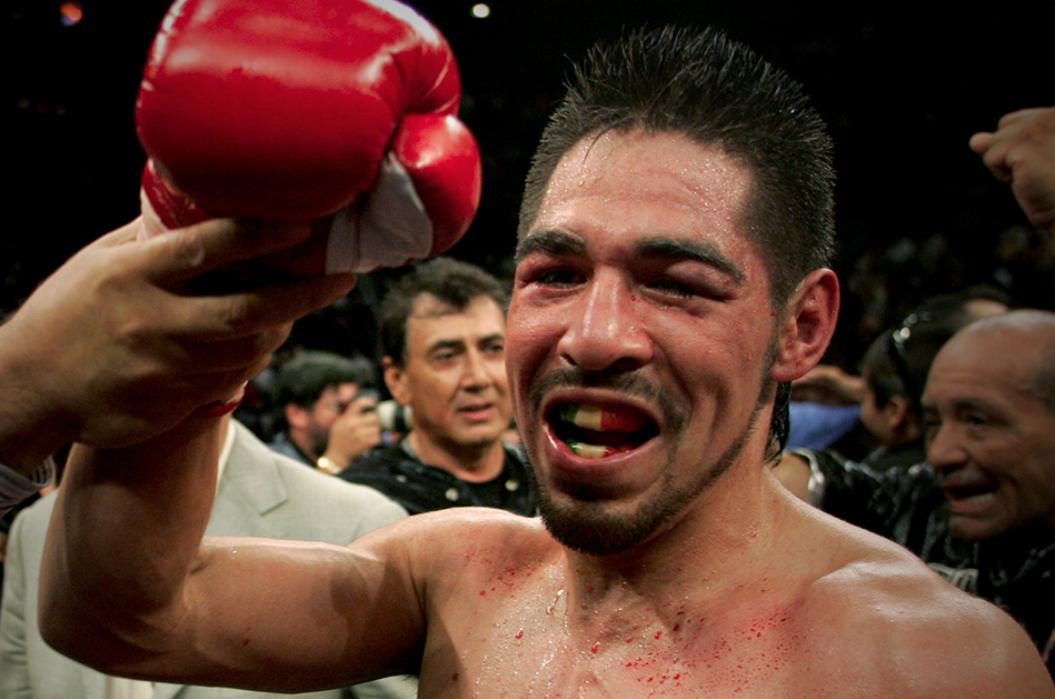 "石膏手"马加里托和"糖块"莫斯利的拳坛恩怨