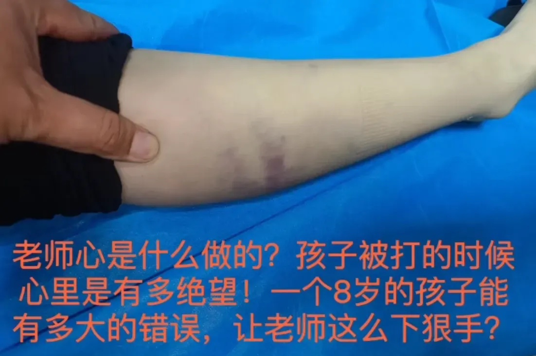 涉事人员不顾孩子性命,用视频推卸责任,青岛这起惨案令人发指!