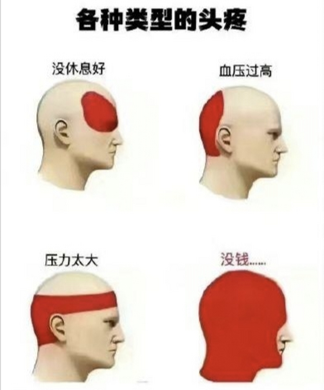 我是没钱的头疼,你呢,[笑哭]