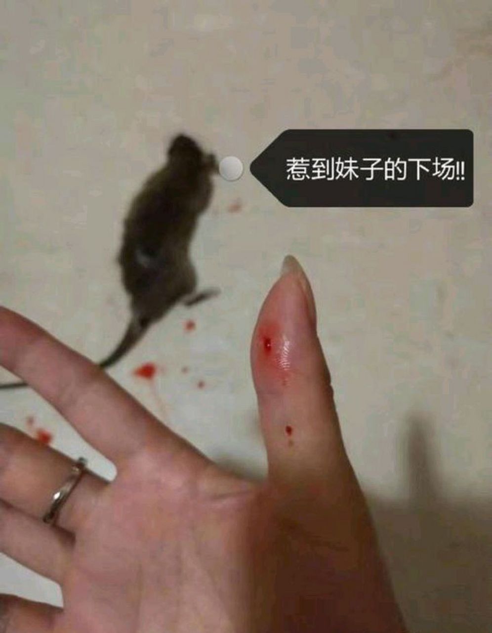 女子徒手抓老鼠玩不慎被咬伤,打疫苗花了1000多.