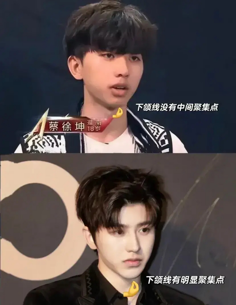 蔡徐坤整容前后对比,这是同一个人你信吗?