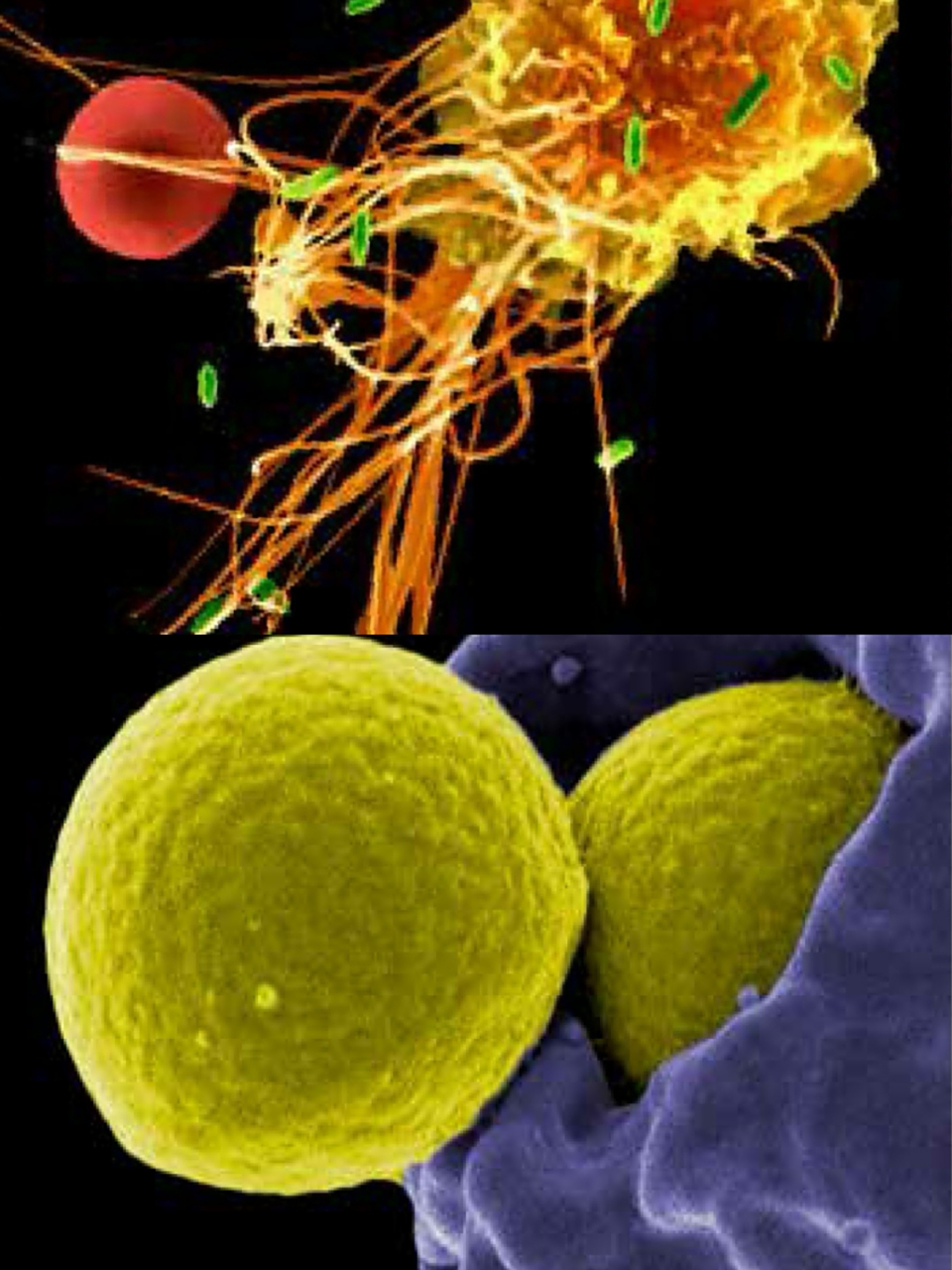 电镜下巨噬细胞和中性粒细胞杀灭细菌的状态…它们均属于白细胞.