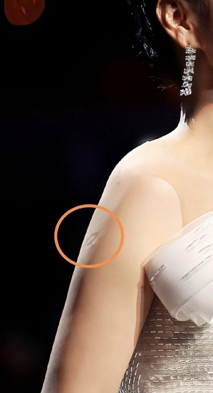 为什么大部分人手臂上都有这个胎记?