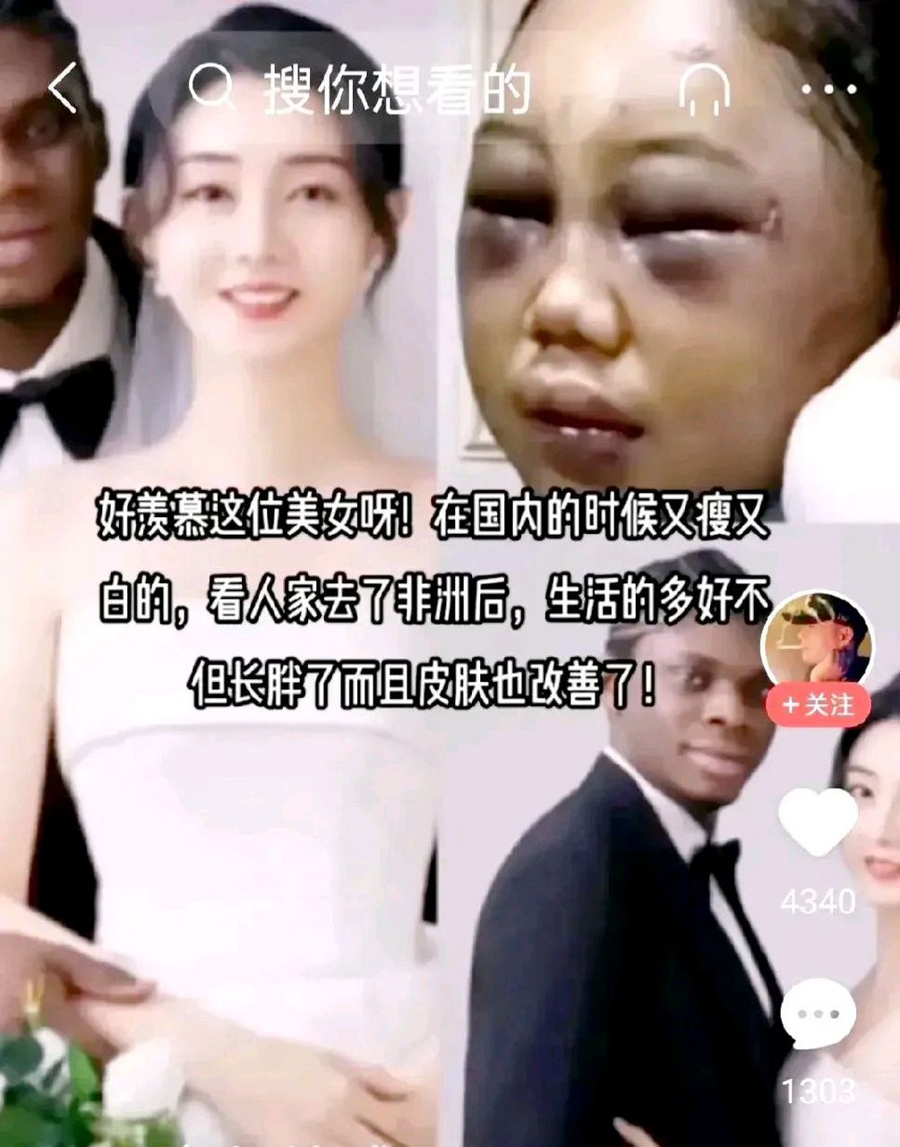 最近一名远嫁非洲黑人的中国女子被打成了猪头上了热搜,当时是在读
