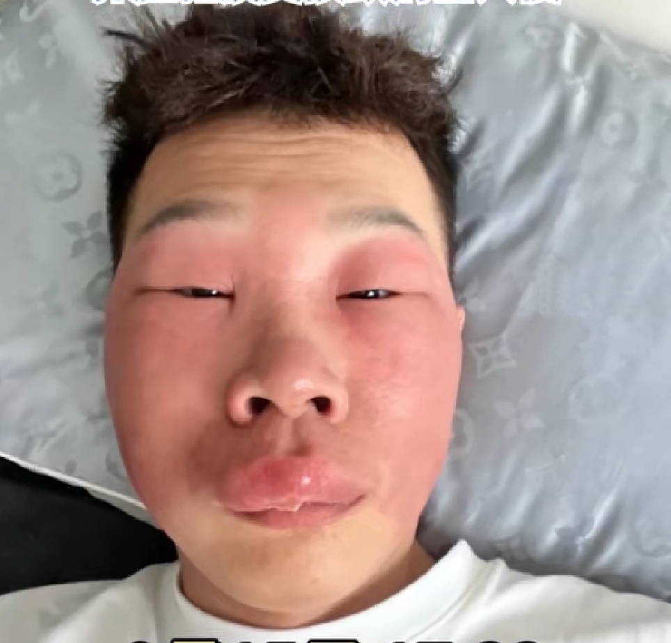 昨天,刷手机刷到这样一条新闻. 小伙因长期抠鼻子习惯且大便不畅通