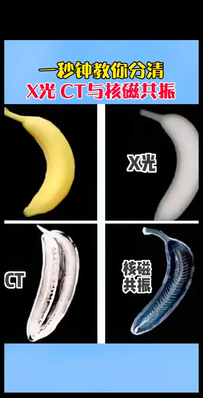 一张图告诉你分清x光~ct~核磁区别