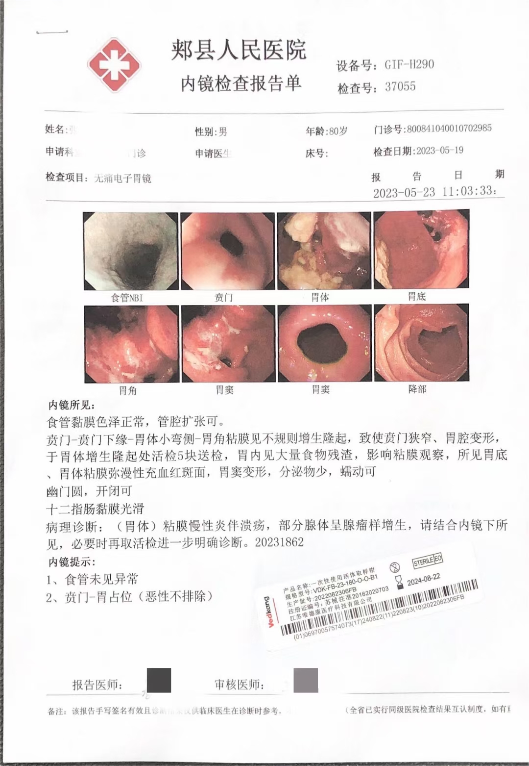 让胃ca患者吃下饭