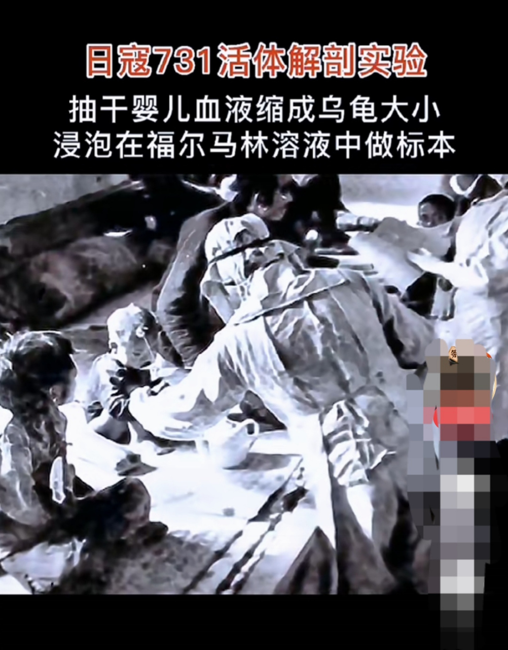 浸泡在福尔马林溶液中做标本!看后你怎么想的?告诉我好嘛?