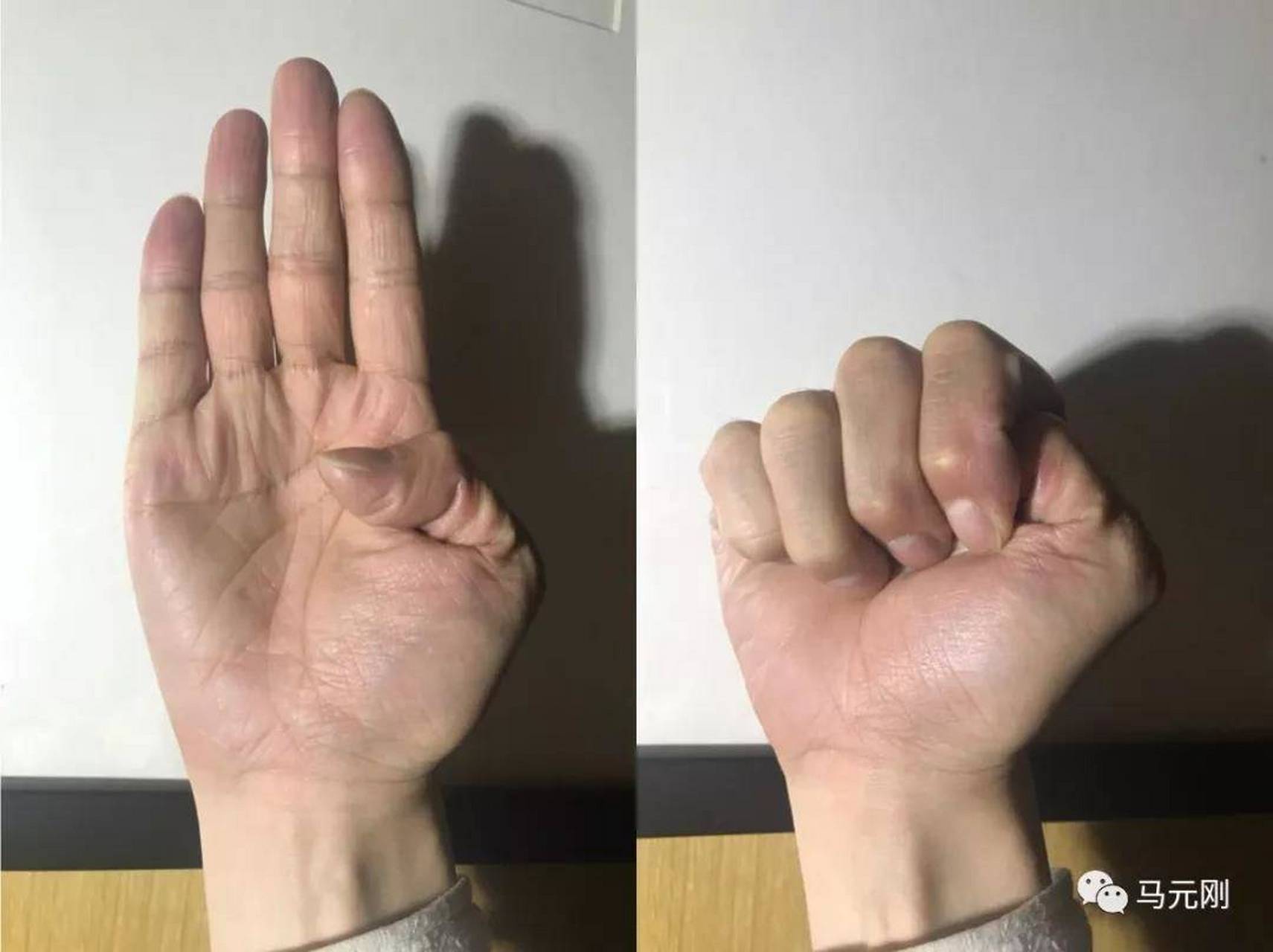 养生本草小课堂 小小手势大能量(握固法) 道家养生的常用手式,晋朝