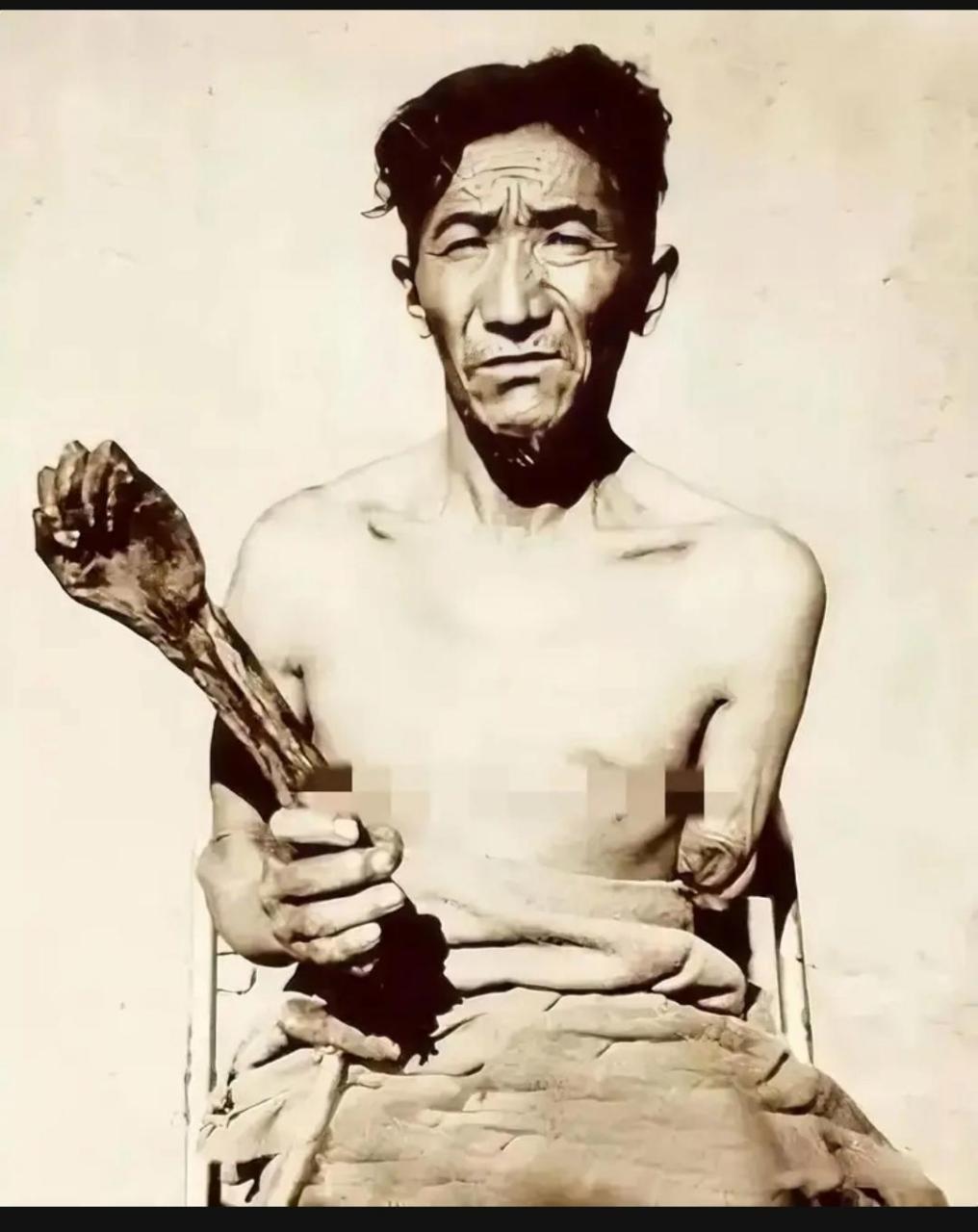 这是50年代,西藏的一名农奴展示自己被砍的胳膊的罕见的照片.
