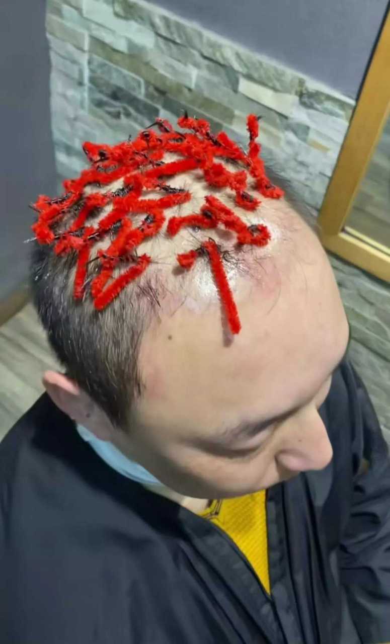大哥就这几根头发也不放过,最后的倔强啊!