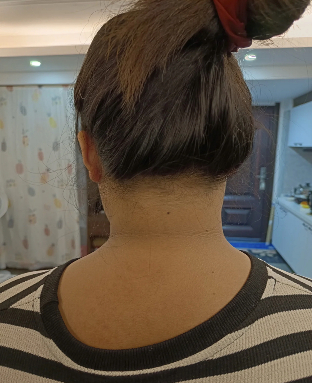 胖子也分颜色:  若发现自己面色偏暗,眼圈和脖子呈现黑色,食欲难以