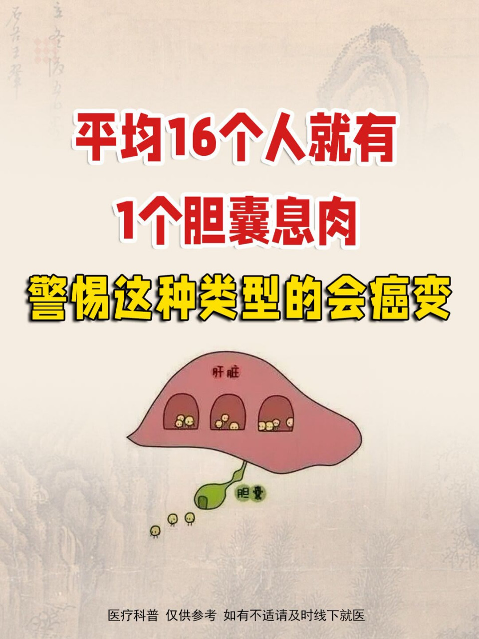 平均16个人里,就有一个胆囊息肉,警惕这种癌变类型!