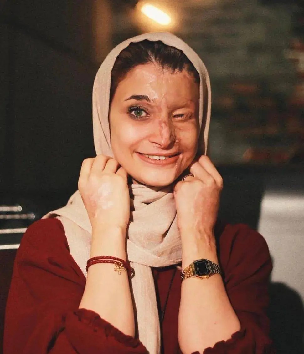 "伊朗最美的女人."但刹那间就被摧毁了