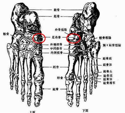 趾探中国人的足迹 解析成年人缺损第五根脚趾骨现象