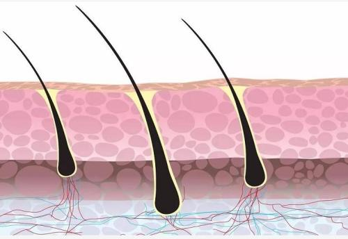 让毛囊"死亡"的三个因素是什么?