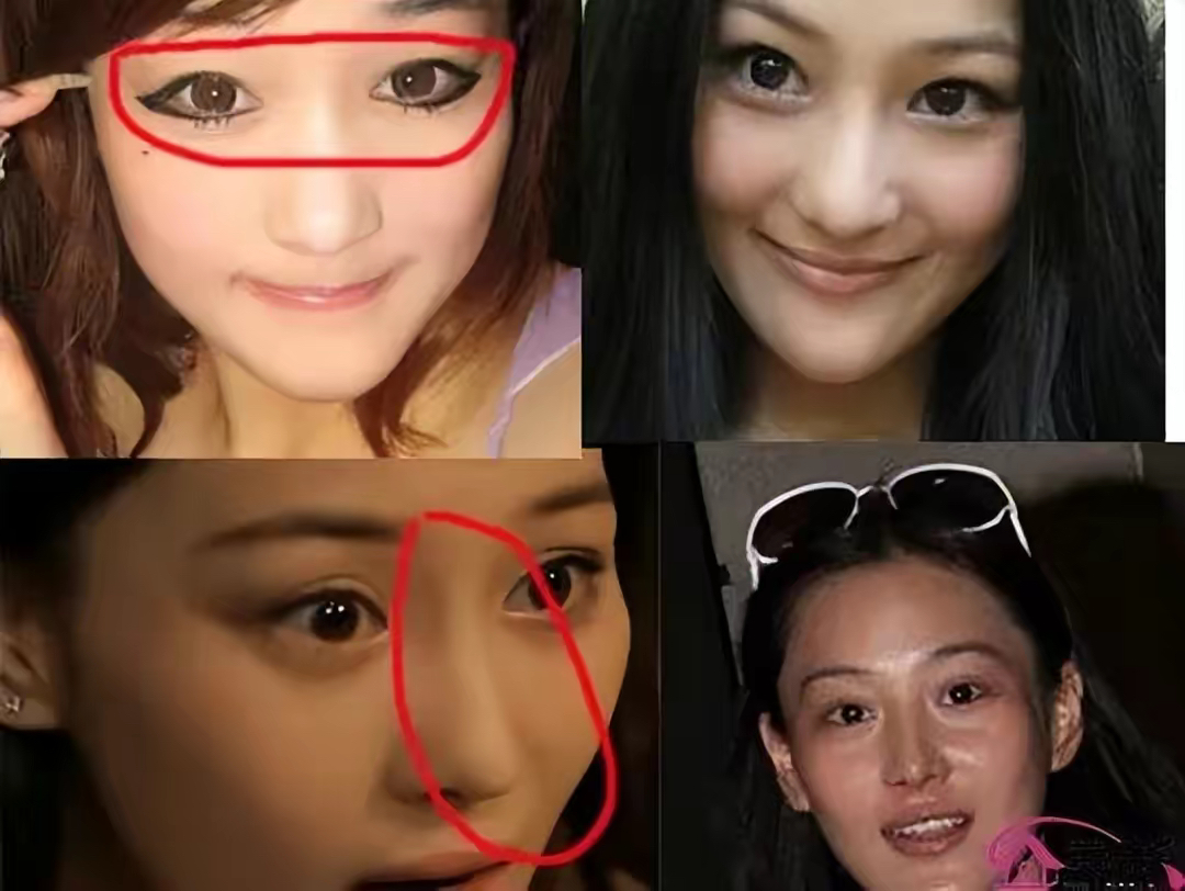 张馨予近照大变样,被质疑整容割了双眼皮,本人发声否认没微调