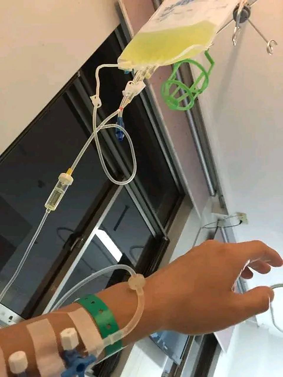 一天马丽发烧了很严重,就去医院打点滴,护士扎了好几次都扎歪了  她很