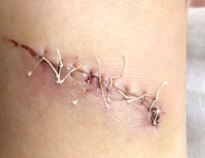 孩子商场玩耍时摔倒受伤,家长却哭着要商场负全责:三万不能少