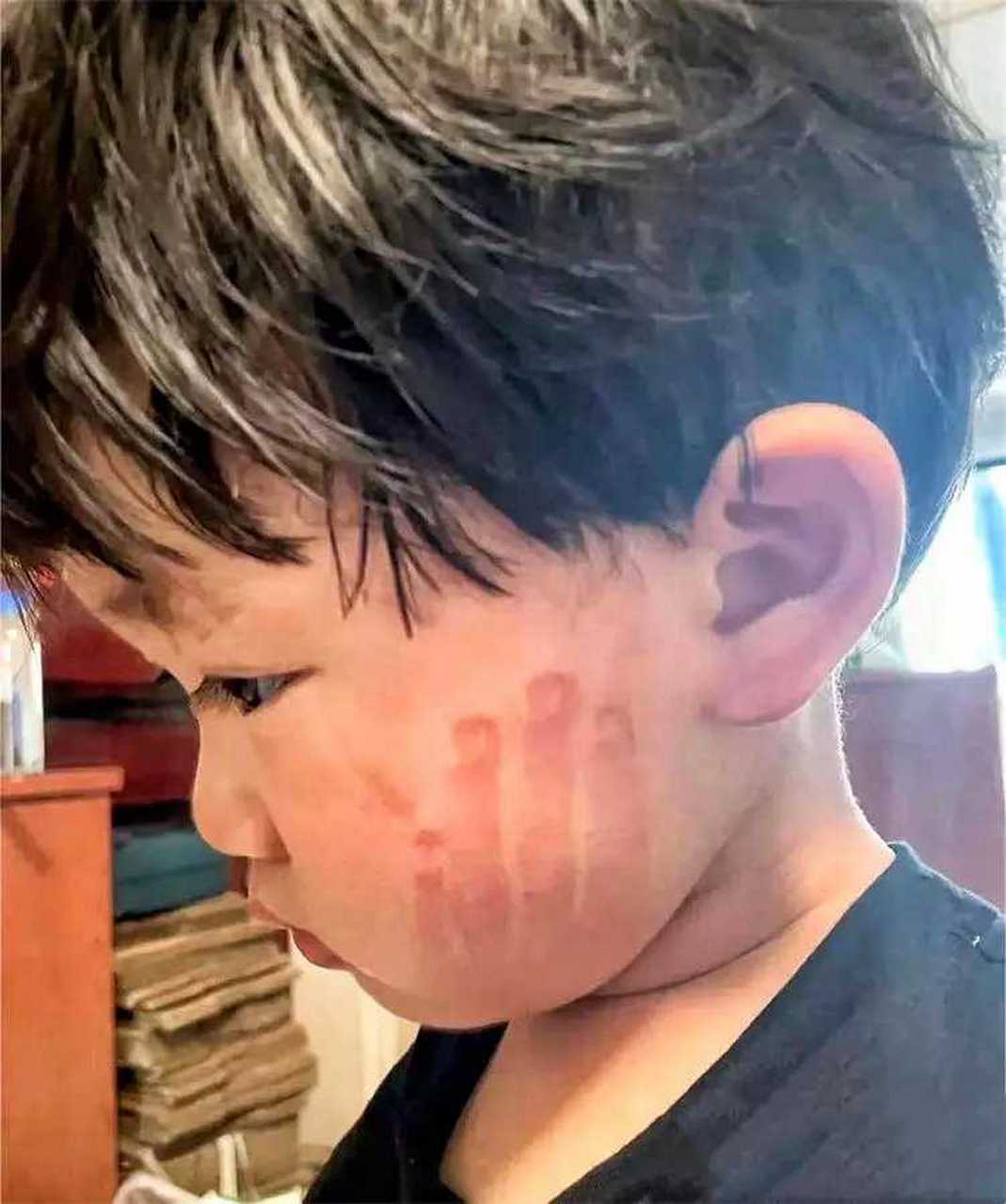 看到孩子脸上的手掌印,要不要找班主任?