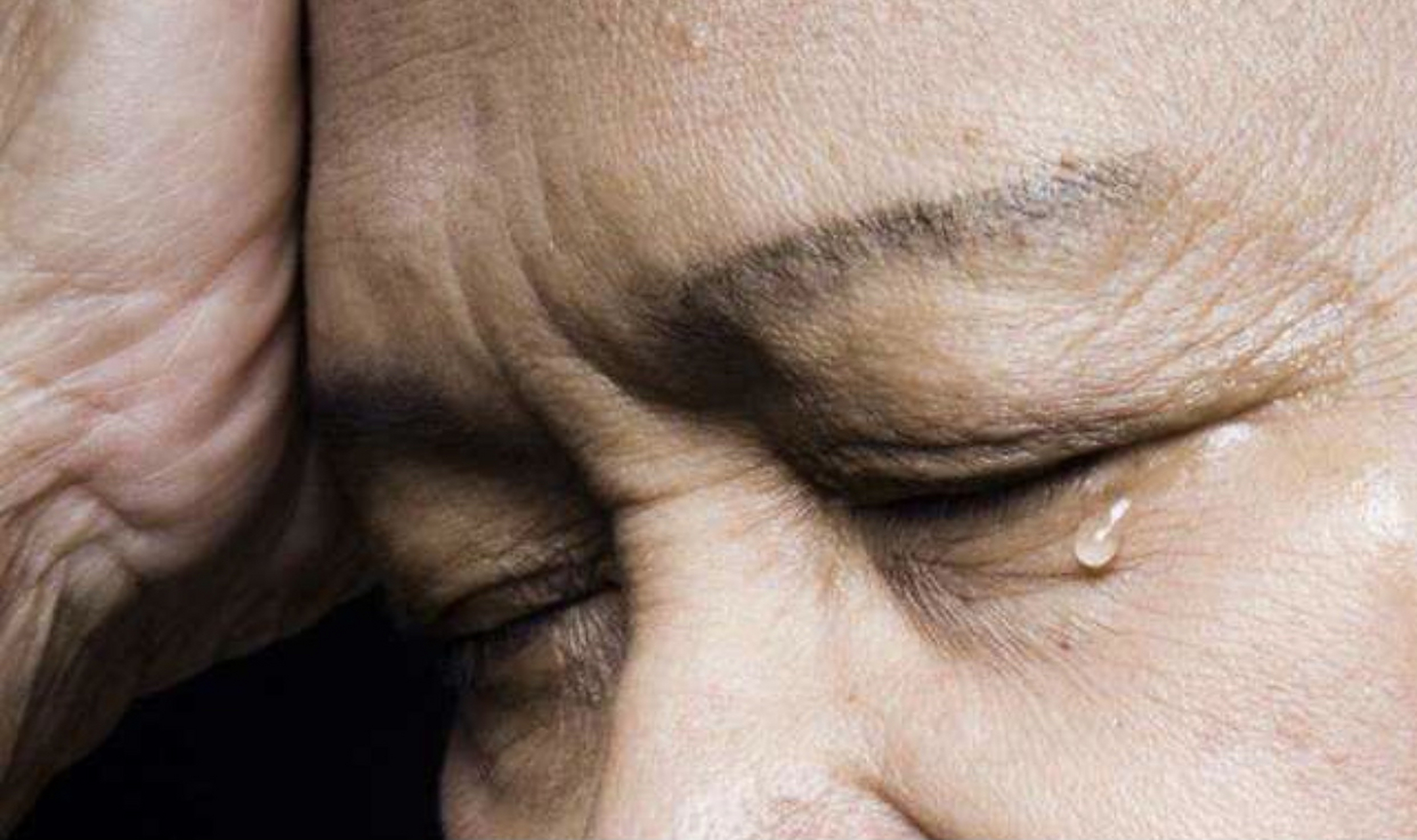 老年人眼睛经常流眼泪怎么办啊?