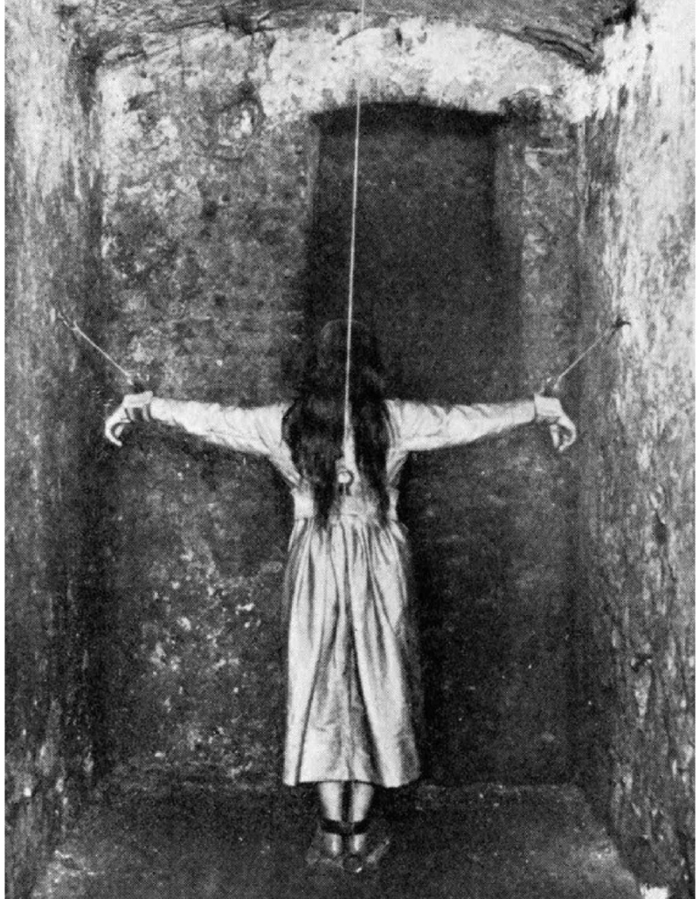 法国,因精神疾病被铁链锁住的女子.