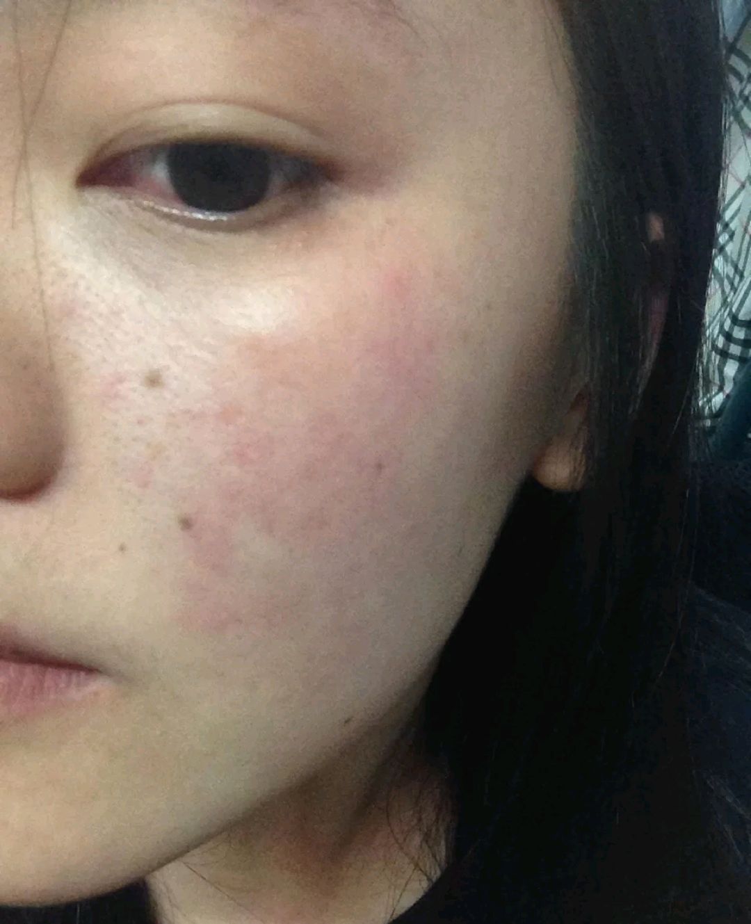 干敏皮换季护肤攻略:告别干燥泛红起皮!