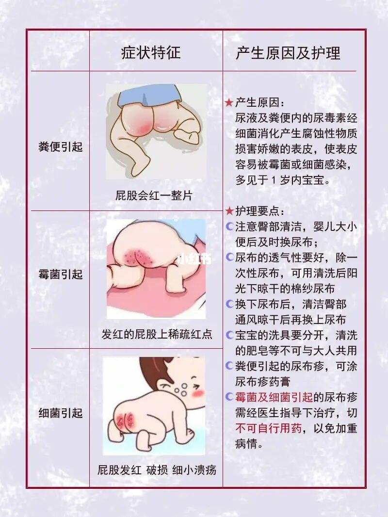 女婴尿布疹怎么办图片