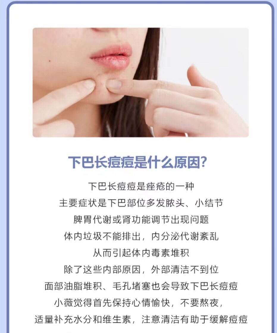 下颚长痘痘的原因图片