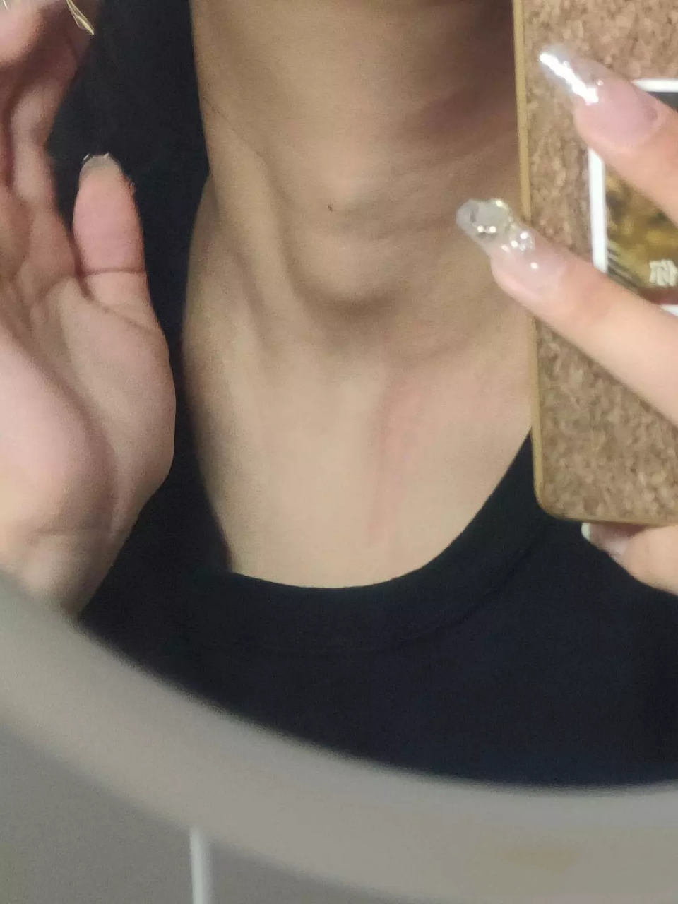 网友:请问我一个女生为什么会有喉结,很难办啊[泪奔]