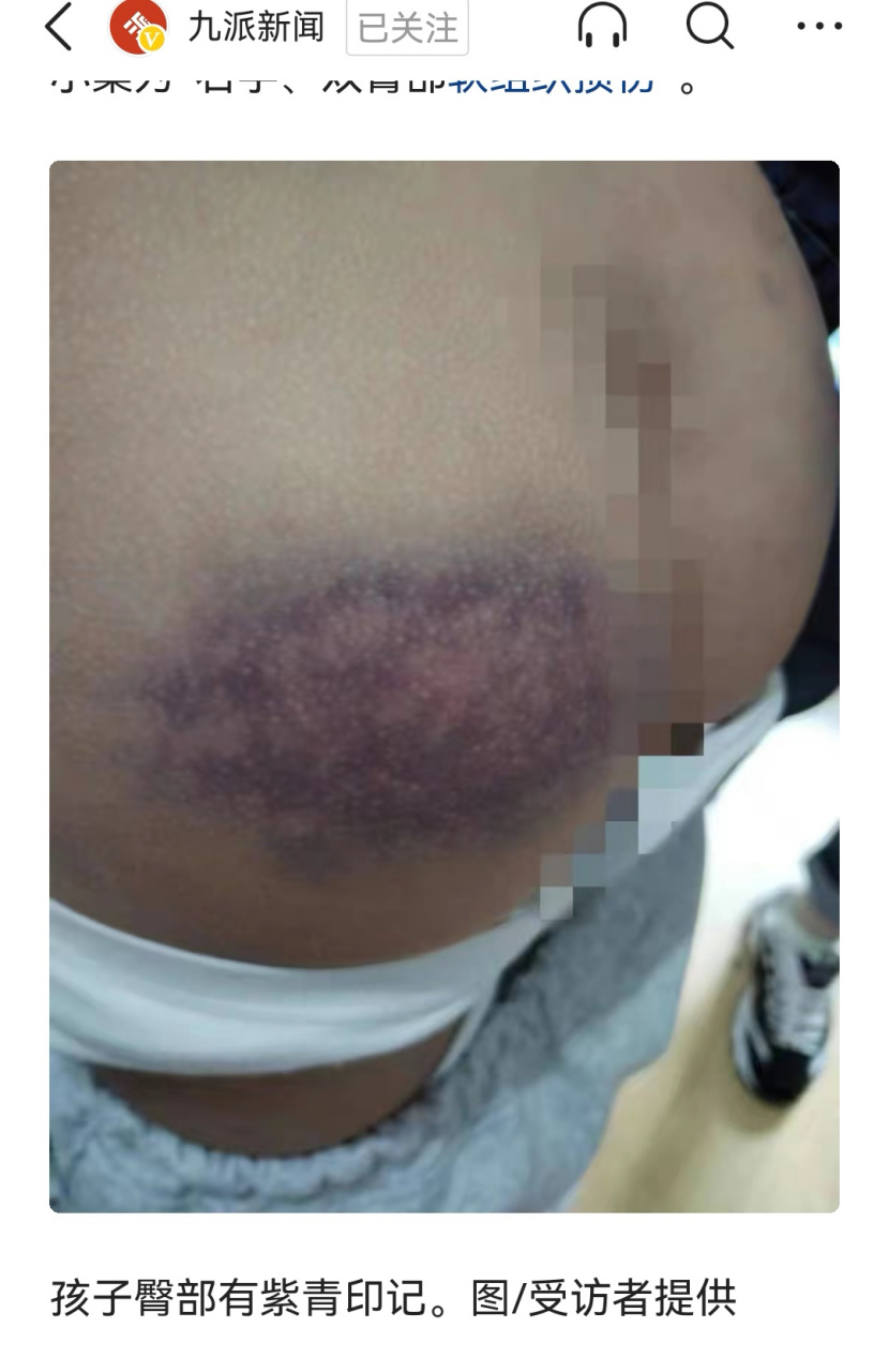 教育部门:出于教育目的非恶意殴打