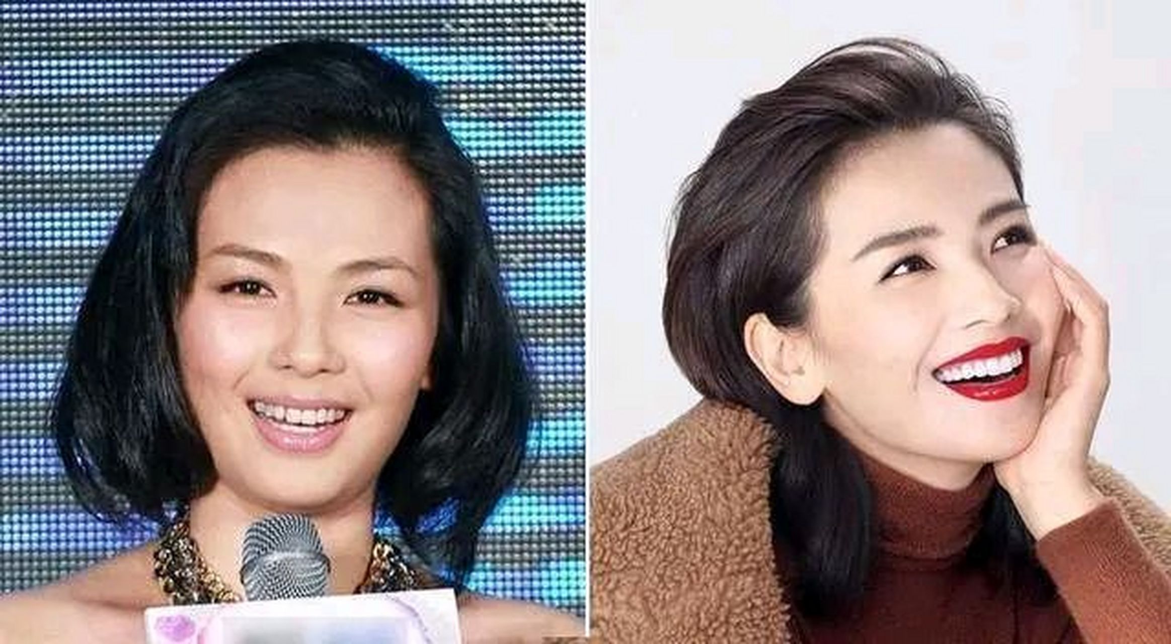 刘涛因牙齿不好看惨遭广告方淘汰,她直接拔光了所有的牙齿,花300万装