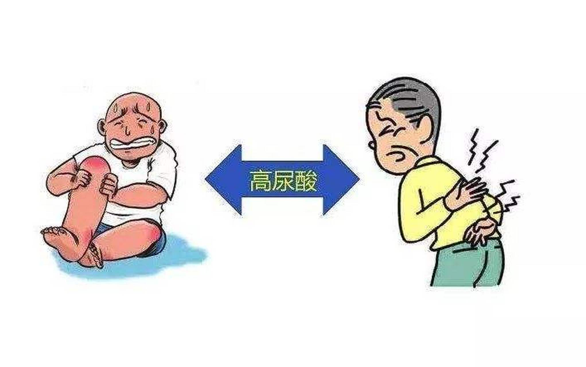 高尿酸血症怎么把尿酸降下来 高尿酸是一种常见的病症,食用过多的高