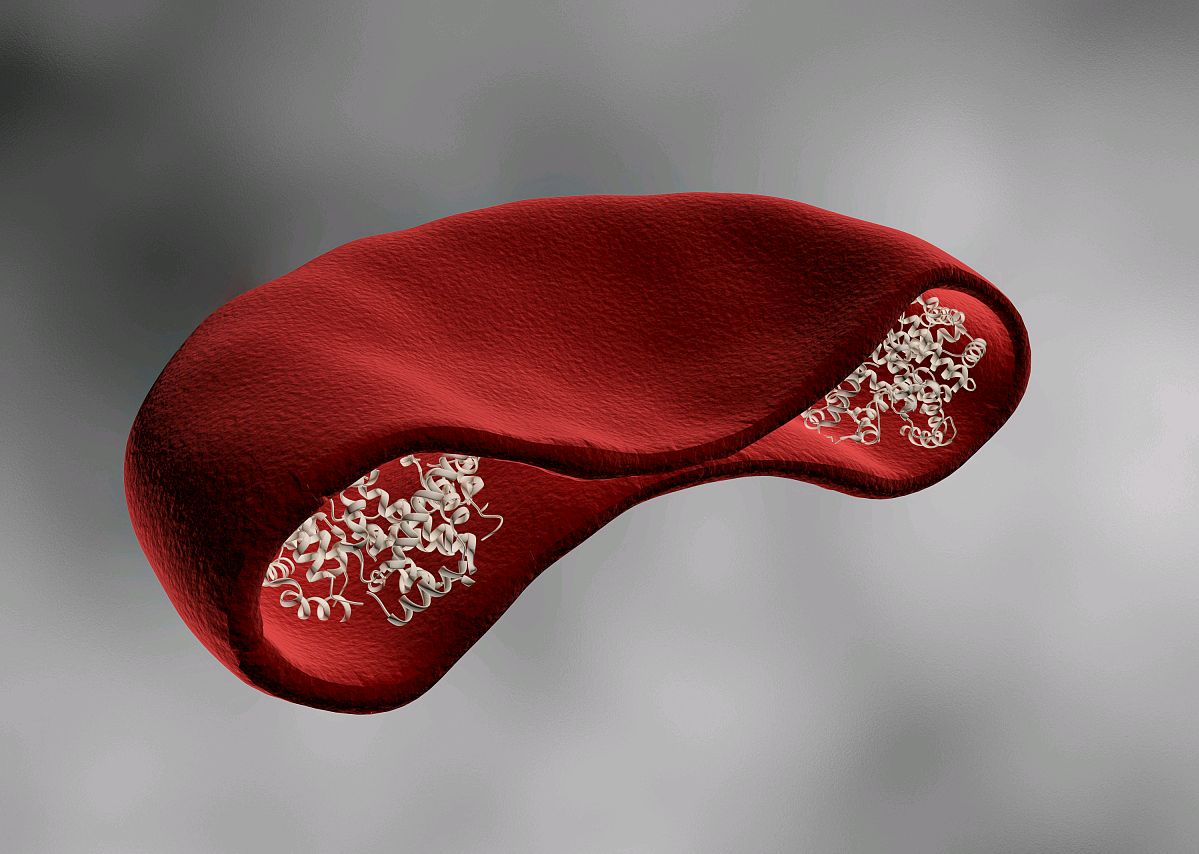 平均红细胞血红蛋白指标升高的原因