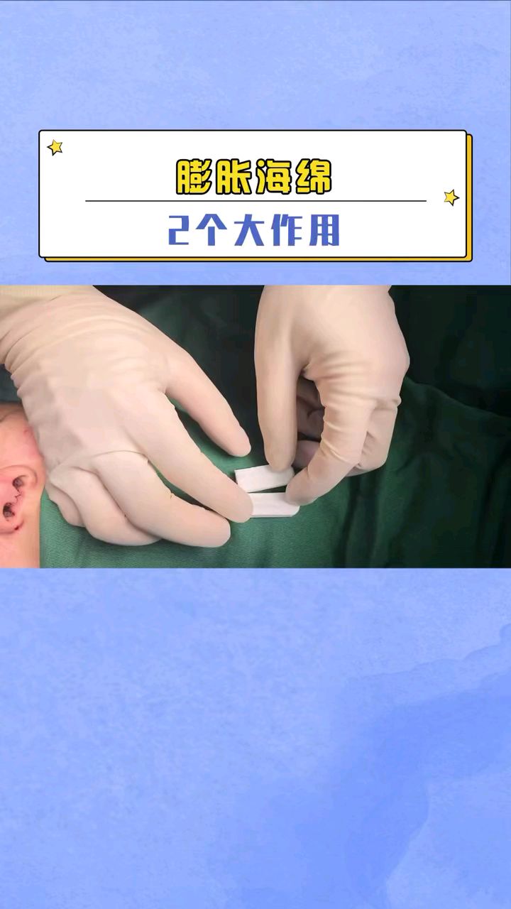 隆鼻后塞的膨胀海绵,竟有这么多好处!-度小视