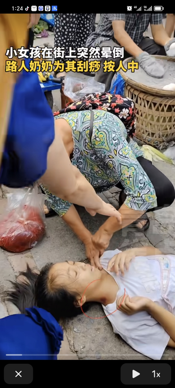 小女孩在街上突然晕倒,老奶奶不顾劝阻为其刮痧,掐人中,最终小女孩