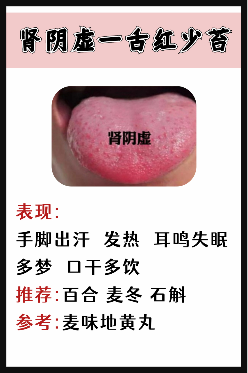 肾阳虚,肾阴虚以及肾气虚有何差别,老中医亲自教你分清,一看便知!#健