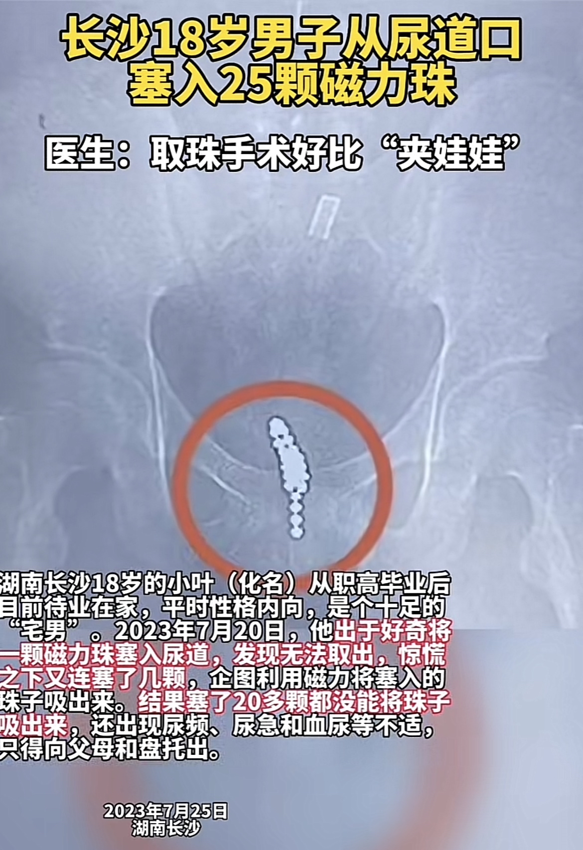 磁力珠危害=磁力珠的磁对孩子有影响么
