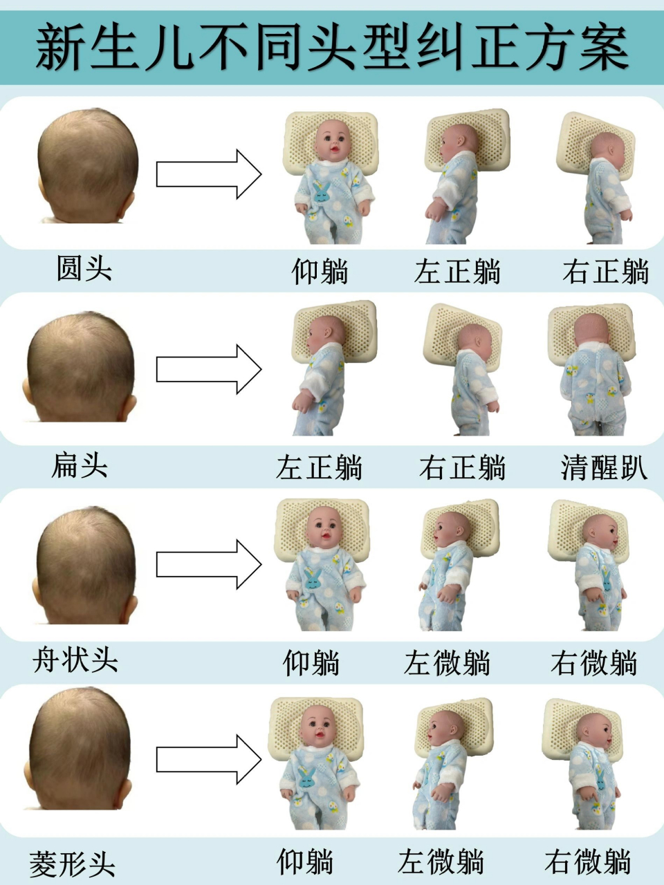宝宝头型矫正,看这一篇就够了